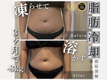 サロン ド パーフェクション(Salon de Perfection)