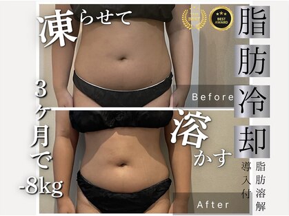 サロン ド パーフェクション(Salon de Perfection)の写真
