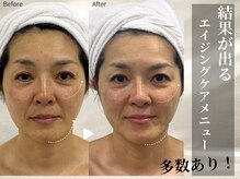 エステティックサロン アールグレーの雰囲気（エイジングケアが得意！40代以降のお悩み改善もお任せください！）