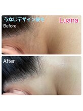 ルアナ(Luana)/うなじデザイン脱毛