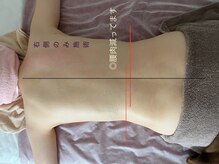 ナチューラ(Natura)/痩身系リンパ・はみ肉スッキリ！