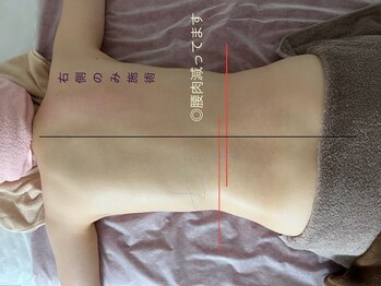 ナチューラ(Natura)/痩身系リンパ・はみ肉スッキリ！