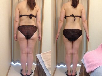 ハッテンビューティーパーク 神戸店(Hatten Beauty Park 810)/モニター様ビフォーアフター