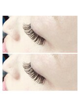 ボラーレ(volare)/フラットマットラッシュ