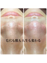 ピエル 北千住店(PIEL)/毛穴も肌も人生も変わる