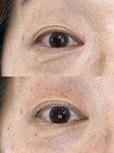 ダーム ド ローズ(Dame de rose)/【まぶたが上がるまつ毛パーマ】