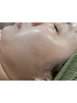 お肌をきれいにしたい