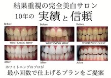 ホワイトニングショップ 緑橋店