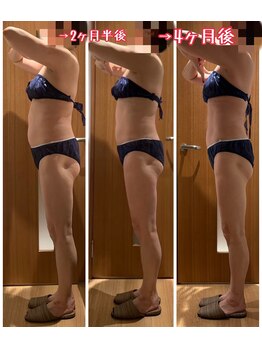 パルティール 銀座店 partir/年齢問わず効果絶大！【銀座】