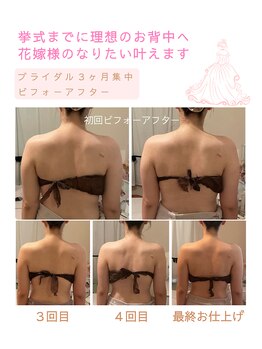 ティアラ(Tiara)/