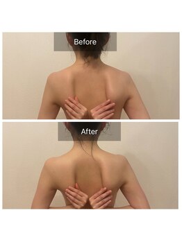 ベンザイ 新潟店(BENZAI)/ガチガチ肩甲骨