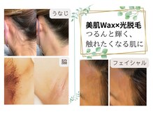 サーラ(SA-RA)の雰囲気（最先端脱毛機器ルミクス使用！Waxを併用で減毛率4倍の効果☆）