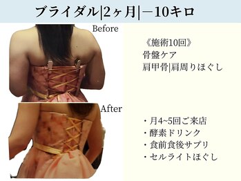 京都フォーエイチ(京都4H)/挙式前|2ヶ月|-10キロ|施術10回