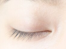 ビー バイ アイキャンディー(B by eye candy)/施術前 [閉じ] before