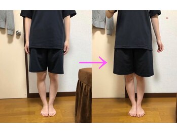 美容整体サロン オオカンシャ(okansha)/O脚矯正☆