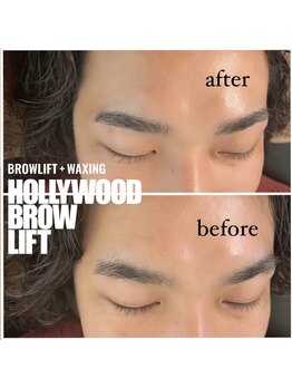 アール(R')/ハリウッドブロウリフト