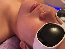 クオーレ 福津(cuore)/顔脱毛