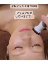 メディカルサロン ティアラ 亀有本店/【プラズマシャワー】