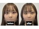 ヒナサク 川崎 八丁畷(hinasaku)の写真
