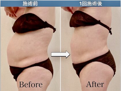 ユウサロン(友Salon)の写真