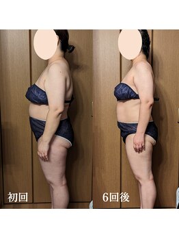 ルマ(Rumah)/コリとむくみ解消で変わる!