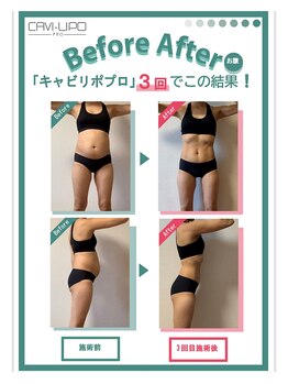 ダリアビューティー(Dahlia Beauty)/2026年本気のダイエット！