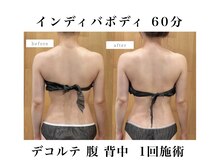 ヒロアフロムベラーノ(HIROA From Verano)の雰囲気（全方向から肩甲骨にアプローチ☆話題肩甲骨はがしをインディバで）