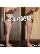 アーユルヴェーダアンドアロマエステ アユス(AYUS)/３０代