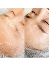 エミュ(emu)/薄眉でもできるemu眉毛パーマ