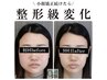 効果No.1☆小顔矯正フルコース4回券　￥83600→￥30000