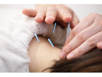 稲田堤鍼灸整骨院/鍼灸施術も好評です