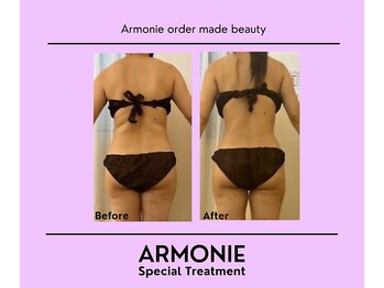 アルモニー(armonie)/背中痩せ！