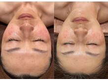 エンソワー(en'sower)/【韓国式肌管理】美白を手入れる