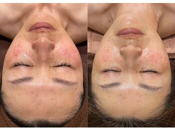 エンソワー(en'sower)/【韓国式肌管理】美白を手入れる