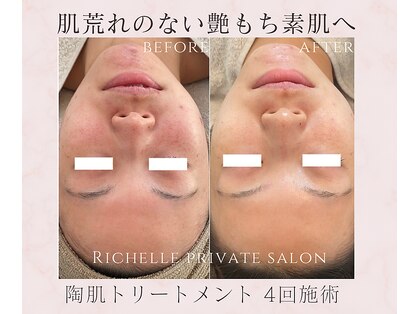 リシェル(Richelle)の写真