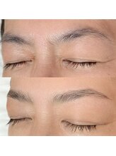 エピュレル(EPURELLE)