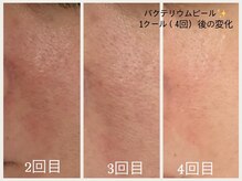 グランボヌール(grand bonheur)/【バクテリウムピール】