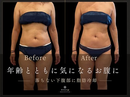 レナータ 池袋店(RENATA)の写真