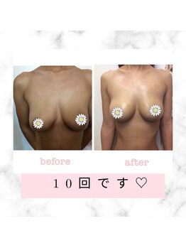 ブロッサム 山内店/諦めないで☆バストは上がります