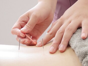 イニシオ 日本橋本院(inicio)/鍼灸もお身体を見て行います