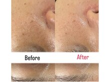 ハイコガオ(HIKOGAO)/プラズマ