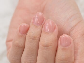 グラシナ 鳥丸店の写真/【NewOPEN/四条烏丸】専門技術で爪の悩みを解消！深爪矯正、長さ出し、フィルインが得意なサロン☆