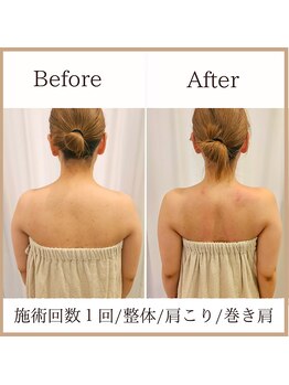 サロンルーチェ(Salon Luce)/ビフォーアフター/施術回数1回