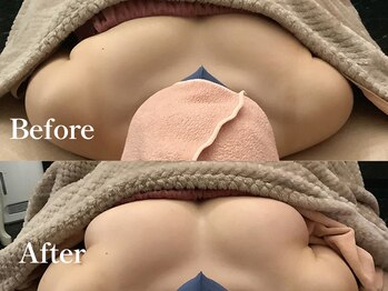 華月(KAGETSU)/8ヶ月で2カップアップ！