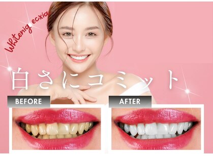 エクシアホワイトニング 調布店の写真
