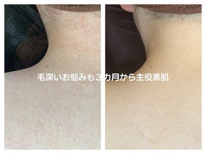 ルミエールブランシュ(Lumiere blanche)の写真