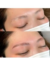 キンキー 広島(kinky)/