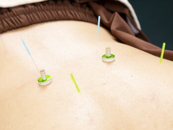 ゆり鍼灸/痛みが少ない鍼、熱くないお灸