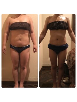 ラサン(Rasun)/ダイエット【症例】