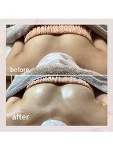 セレーネ(Selene)/お客様before.after